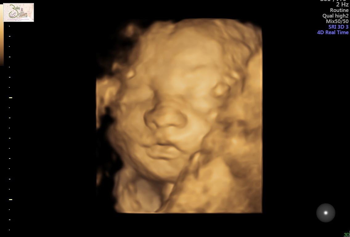 3D Ultrasound Services – LITTLE TICKLES LLC